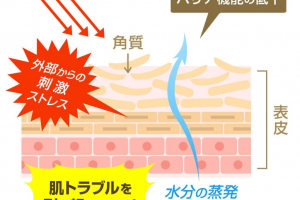 肌トラブルの原因を説明する図解