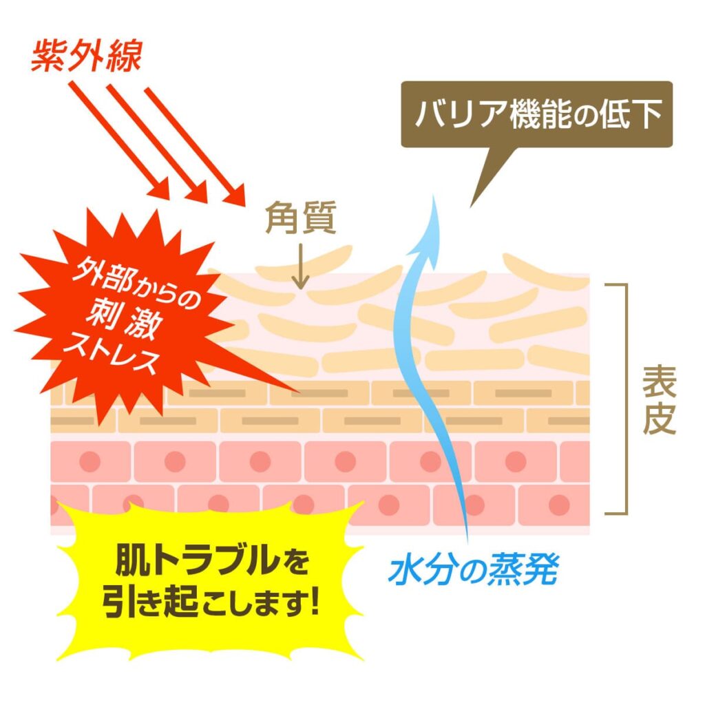 肌トラブルの原因を説明する図解